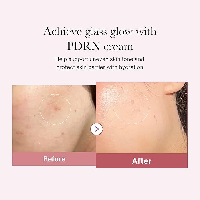MEDICUBE Vegan PDRN Pink Hyaluronic Moisturizing Cream 50ml / 1.69 fl.oz.