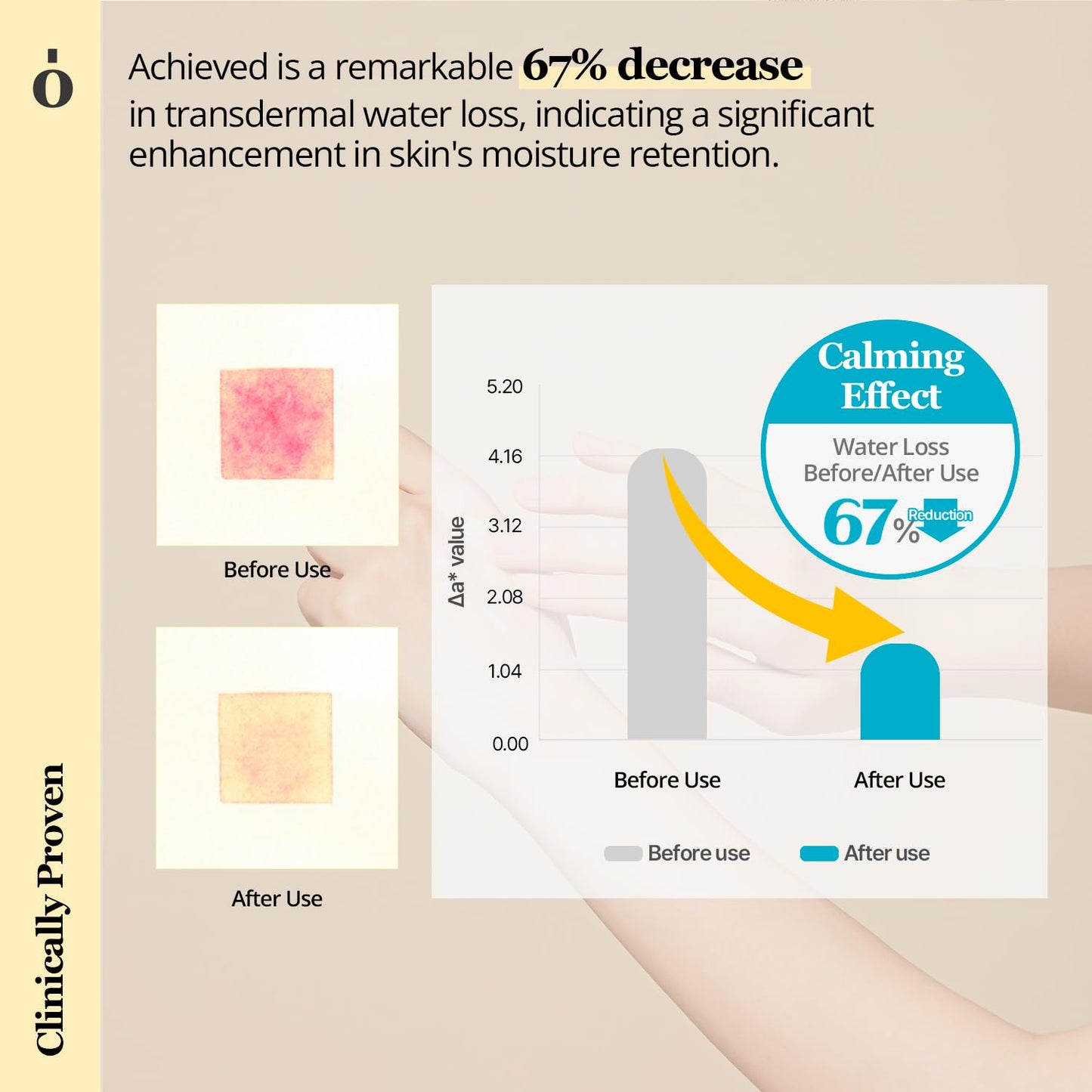 ONGREDIENTS Skin Barrier Calming Lotion 80ml 2.70 fl Oz