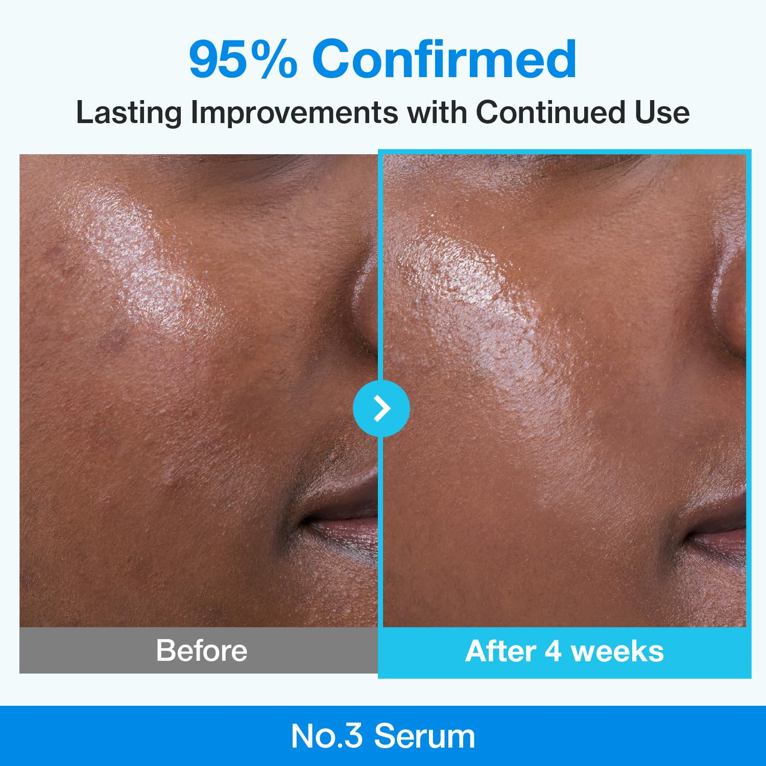 NUMBUZIN No.3 retinol Serum Blue Bio-Retinol Pore Refining Serum 30ml 1.01 fl.0z