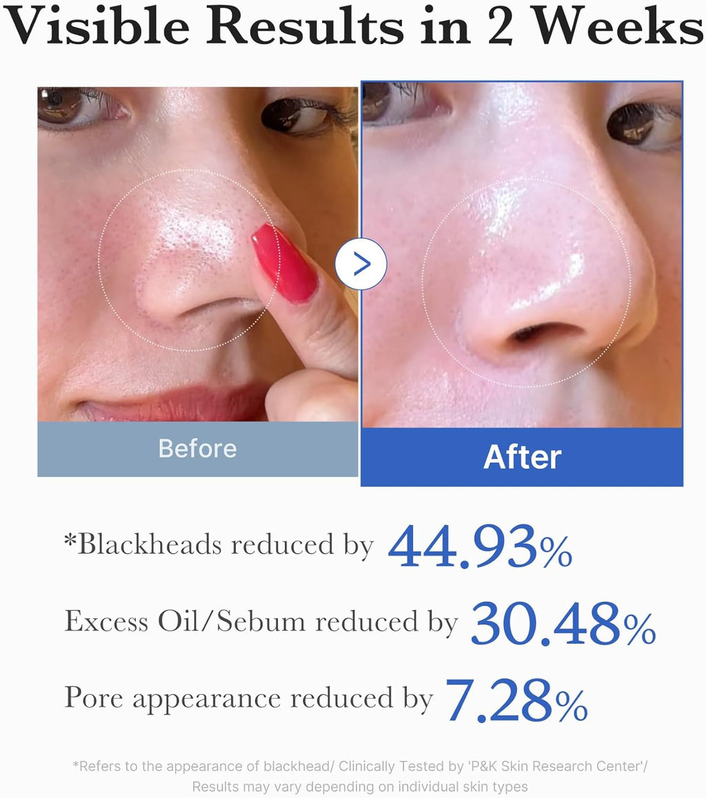 MEDICUBE Zero Pore Pad 2.0 70 Pads
