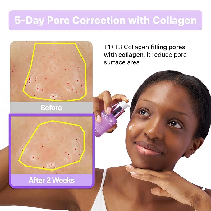 BIOHEAL BOH Probioderm™ Collagen Remodeling Serum 1.01 fl oz (30 ml)