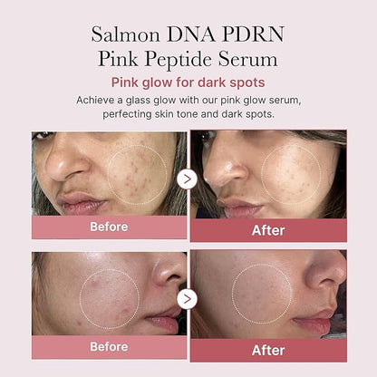 MEDICUBE Salmon DNA PDRN Pink Peptide Serum 30ml 1.01 fl.oz.