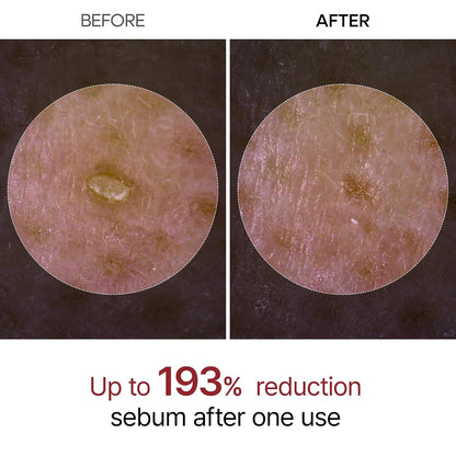 DR MELAXIN Peel Shot Glow White Rice Peeling Ampoule 80ml