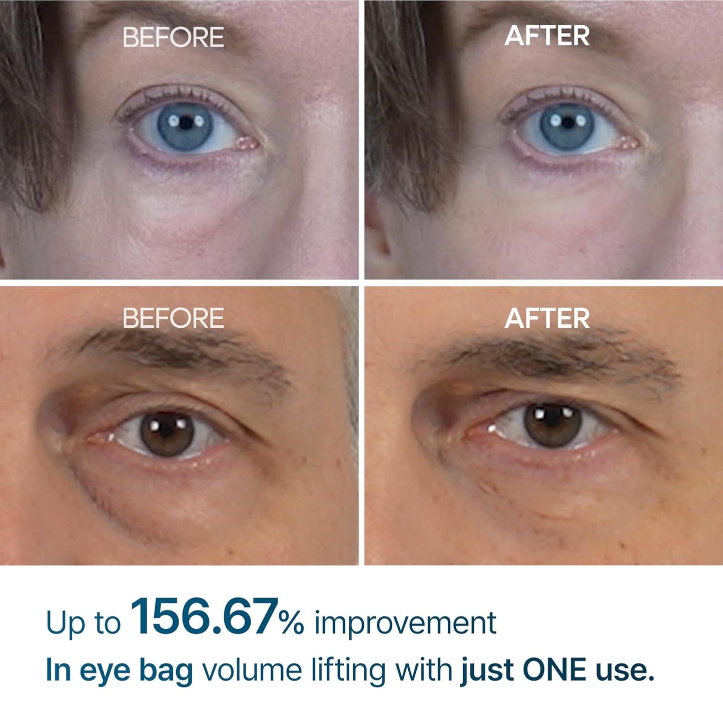 DR MELAXIN Eyephalt Eyebag Cream 10ml