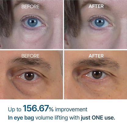 DR MELAXIN Eyephalt Eyebag Cream 10ml