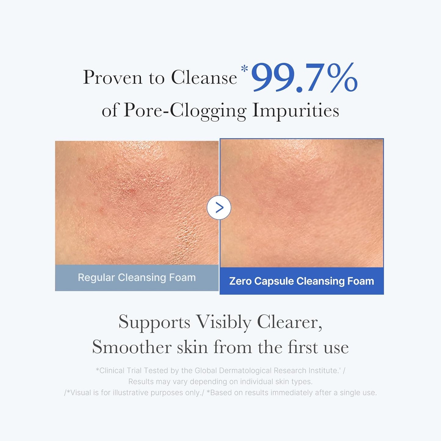 MEDICUBE Zero Pore SA Clear Capsule Cleansing Foam 120g 4.23 oz